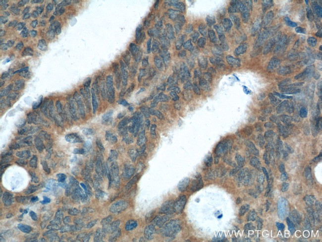 XBP1 Antibody in Immunohistochemistry (Paraffin) (IHC (P))