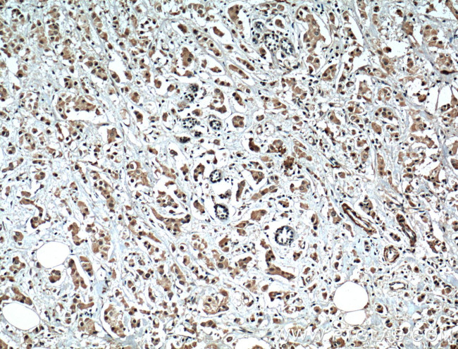 XBP1 Antibody in Immunohistochemistry (Paraffin) (IHC (P))