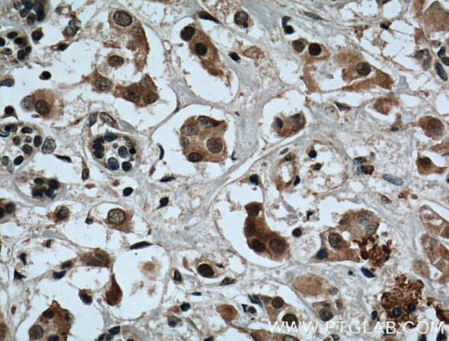 XBP1 Antibody in Immunohistochemistry (Paraffin) (IHC (P))