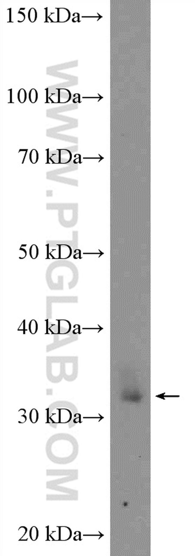 XBP1 Antibody in Western Blot (WB)