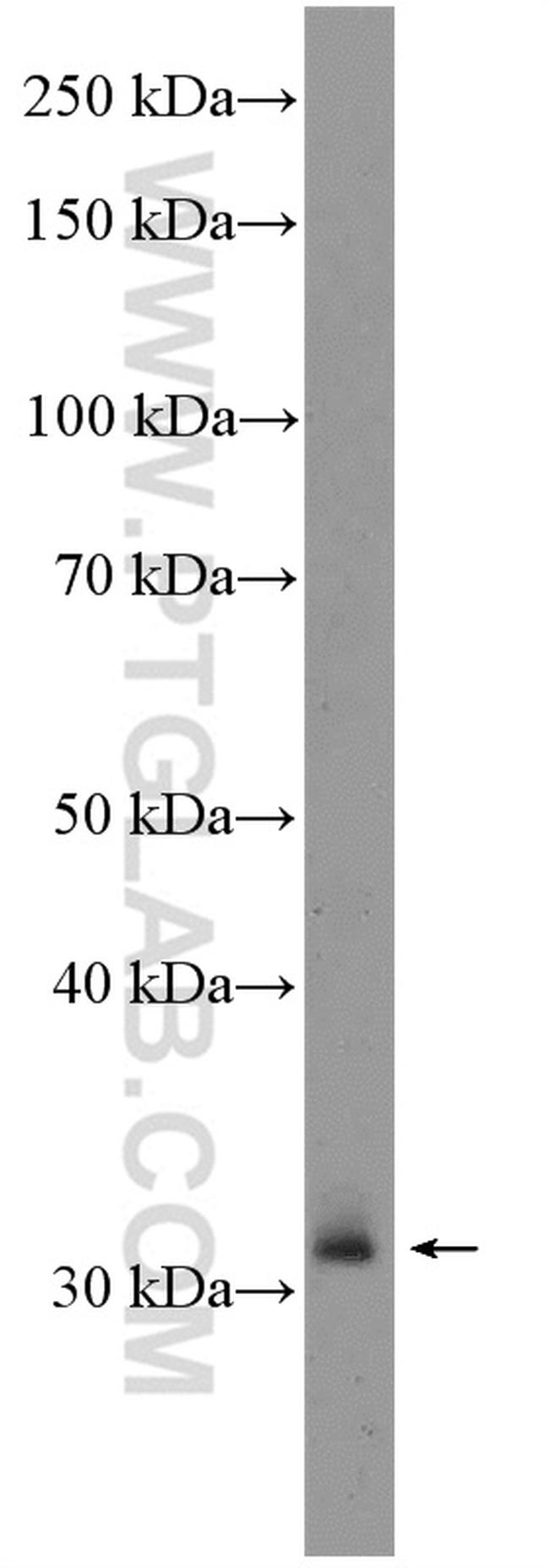 XBP1 Antibody in Western Blot (WB)