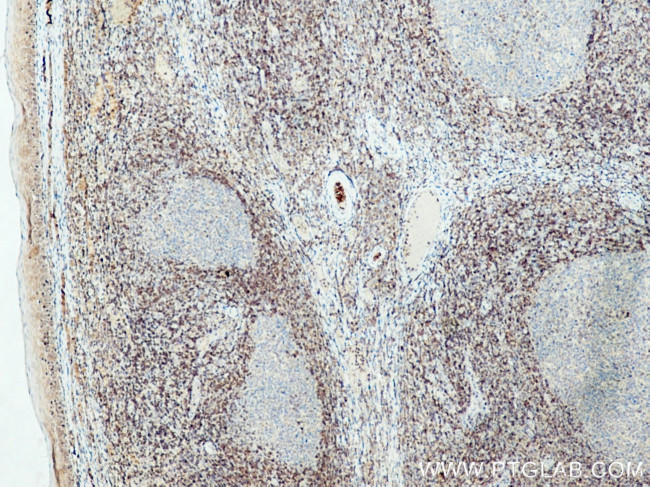 Bcl2 Antibody in Immunohistochemistry (Paraffin) (IHC (P))