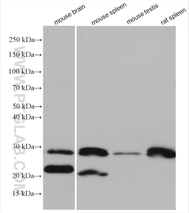 Bcl2 Antibody in Western Blot (WB)