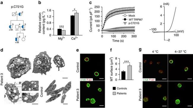 alpha Tubulin Antibody in Immunocytochemistry (ICC/IF)