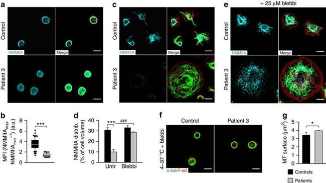 alpha Tubulin Antibody in Immunocytochemistry (ICC/IF)