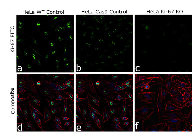 Ki-67 Antibody in Immunocytochemistry (ICC/IF)