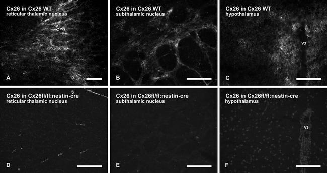 Connexin 26 Antibody in Immunohistochemistry (IHC)