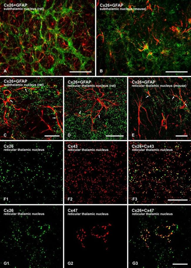 Connexin 26 Antibody in Immunohistochemistry (IHC)