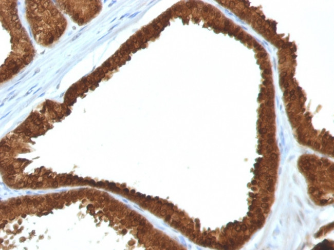 IDH1 (Isocitrate Dehydrogenase) Antibody in Immunohistochemistry (Paraffin) (IHC (P))