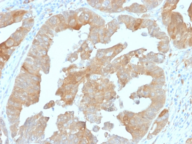 IDH1 (Isocitrate Dehydrogenase) Antibody in Immunohistochemistry (Paraffin) (IHC (P))