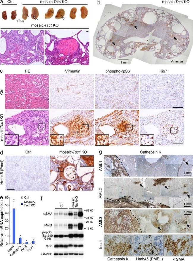 Ki-67 Antibody in Immunohistochemistry (Paraffin) (IHC (P))