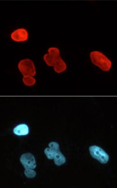 Lamin A/C Antibody in Immunocytochemistry (ICC/IF)