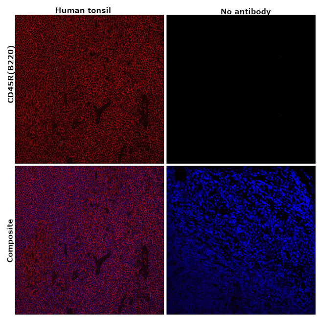 CD45R (B220) Antibody in Immunohistochemistry (Paraffin) (IHC (P))