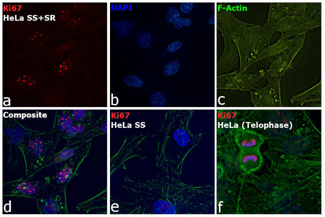 Ki-67 Antibody in Immunocytochemistry (ICC/IF)