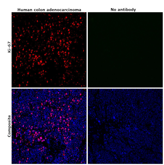 Ki-67 Antibody in Immunohistochemistry (Paraffin) (IHC (P))