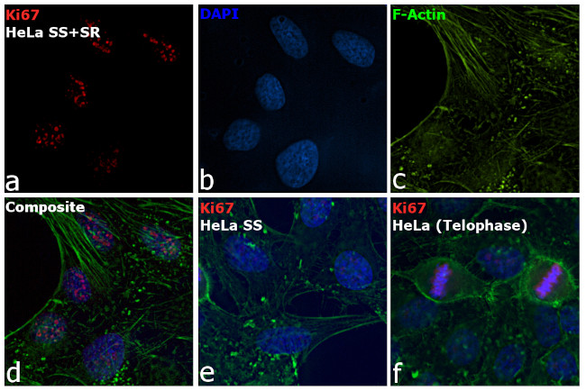 Ki-67 Antibody in Immunocytochemistry (ICC/IF)