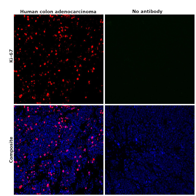 Ki-67 Antibody in Immunohistochemistry (Paraffin) (IHC (P))