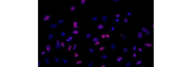 Ki-67 Antibody in Immunocytochemistry (ICC/IF)