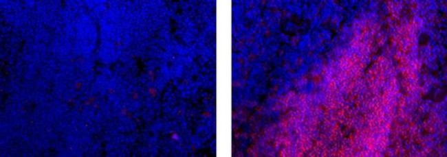 CD45R (B220) Antibody in Immunohistochemistry (Frozen) (IHC (F))