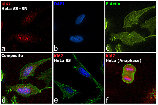 Ki-67 Antibody in Immunocytochemistry (ICC/IF)