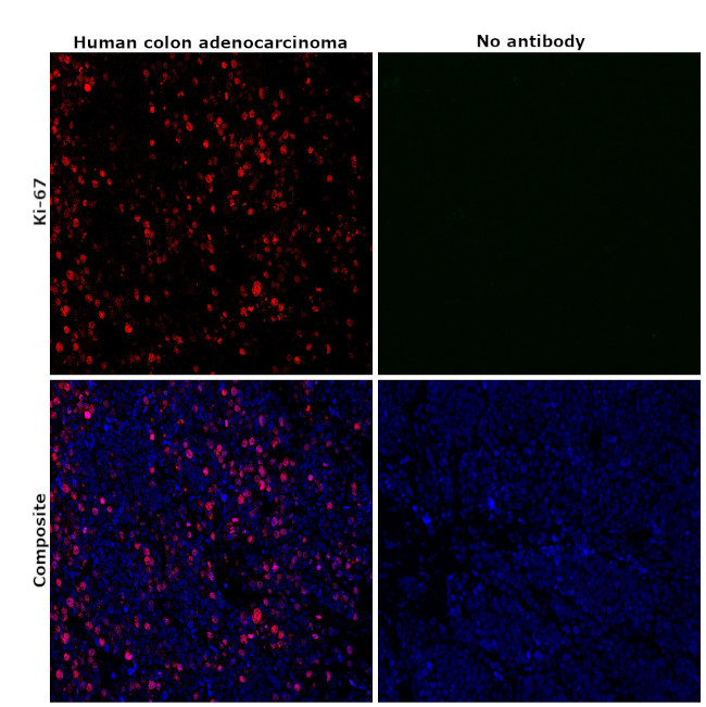 Ki-67 Antibody in Immunohistochemistry (Paraffin) (IHC (P))