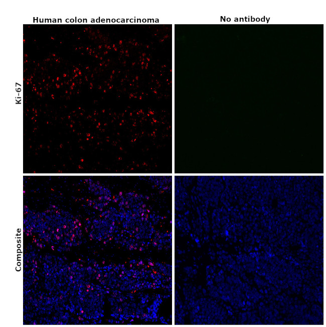 Ki-67 Antibody in Immunohistochemistry (Paraffin) (IHC (P))