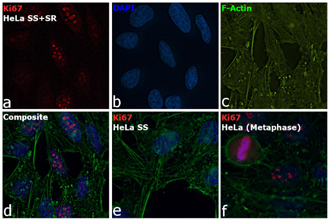 Ki-67 Antibody