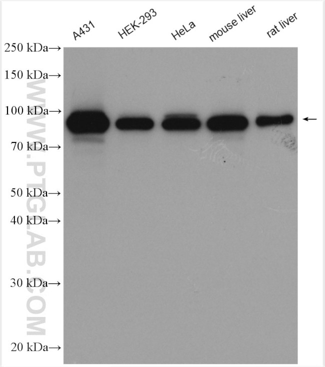 beta-Catenin Antibody in Western Blot (WB)