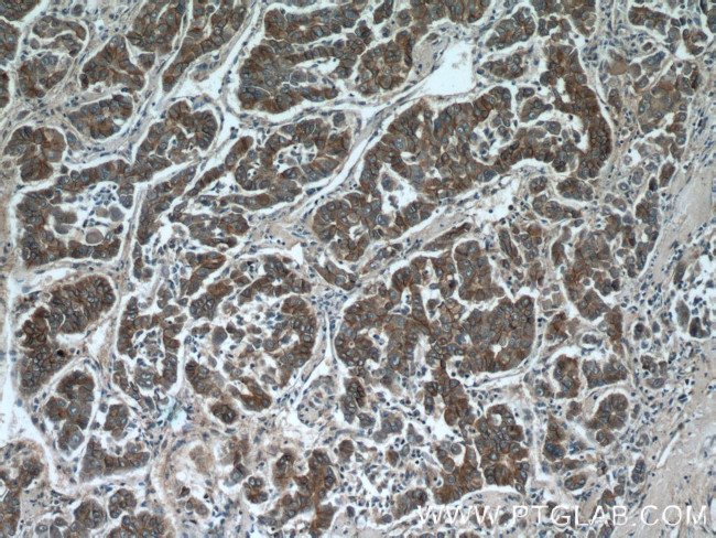 beta-Catenin Antibody in Immunohistochemistry (Paraffin) (IHC (P))