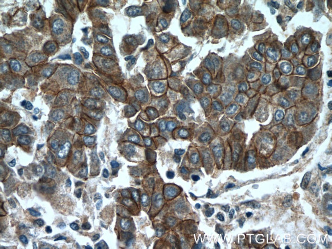 beta-Catenin Antibody in Immunohistochemistry (Paraffin) (IHC (P))