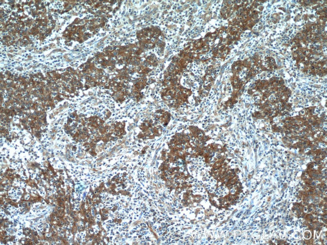 beta-Catenin Antibody in Immunohistochemistry (Paraffin) (IHC (P))