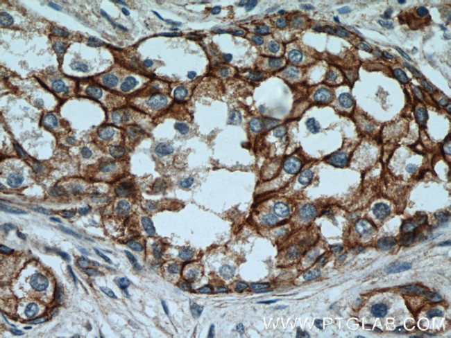 beta-Catenin Antibody in Immunohistochemistry (Paraffin) (IHC (P))