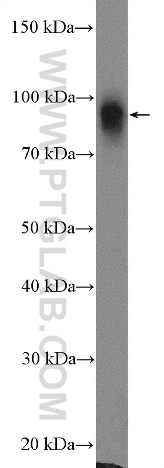 beta-Catenin Antibody in Western Blot (WB)