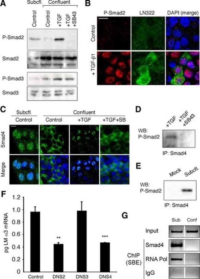 SMAD3 Antibody in Western Blot (WB)