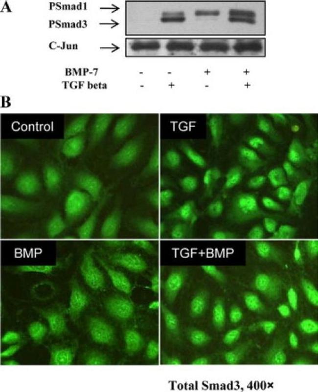 SMAD3 Antibody in Western Blot (WB)