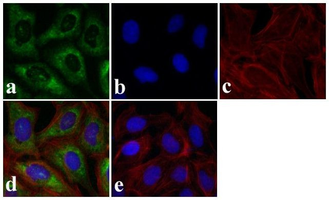 SMAD3 Antibody in Immunocytochemistry (ICC/IF)