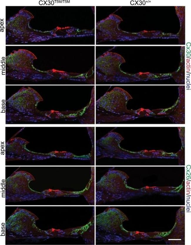 Connexin 26 Antibody in Immunohistochemistry (IHC)