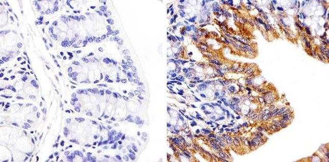 Connexin 26 Antibody in Immunohistochemistry (Paraffin) (IHC (P))