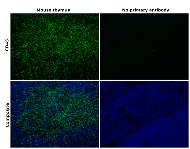 CD45 Antibody in Immunohistochemistry (Paraffin) (IHC (P))