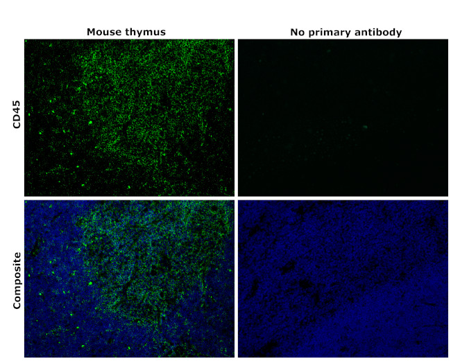 CD45 Antibody in Immunohistochemistry (Paraffin) (IHC (P))