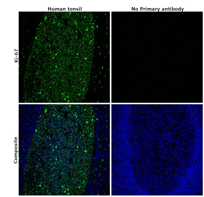 Ki-67 Antibody in Immunohistochemistry (Paraffin) (IHC (P))