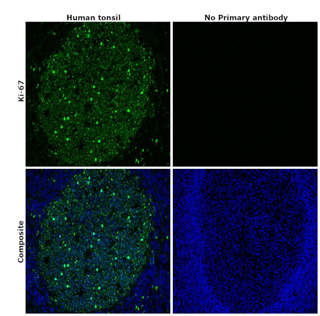 Ki-67 Antibody in Immunohistochemistry (Paraffin) (IHC (P))