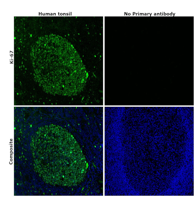 Ki-67 Antibody in Immunohistochemistry (Paraffin) (IHC (P))