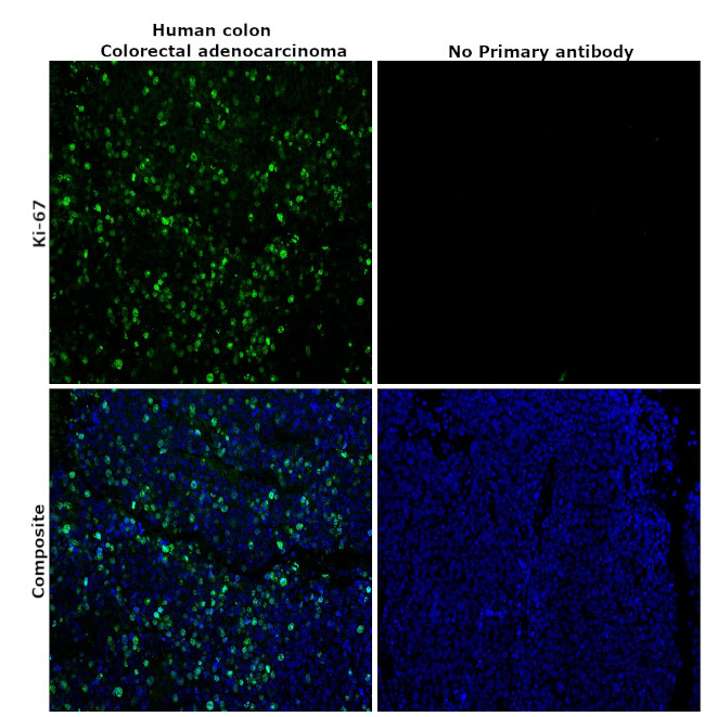 Ki-67 Antibody in Immunohistochemistry (Paraffin) (IHC (P))