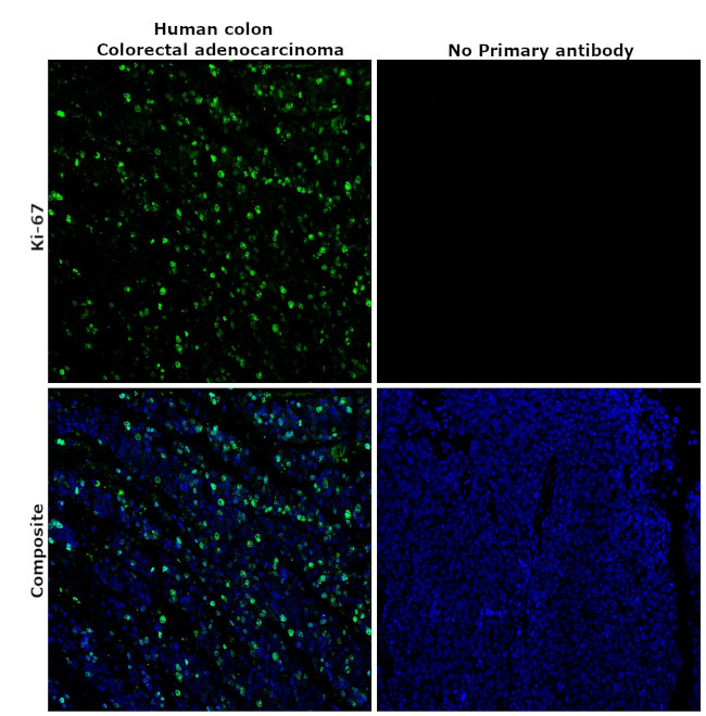 Ki-67 Antibody in Immunohistochemistry (Paraffin) (IHC (P))