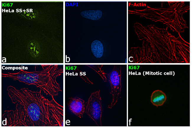 Ki-67 Antibody