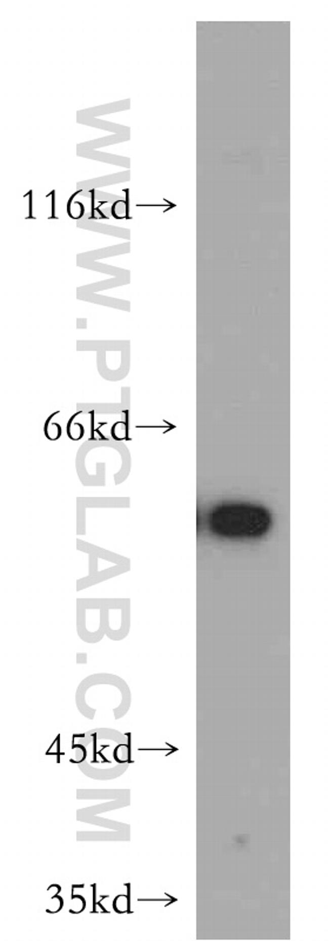 Cyclin B1 Antibody in Western Blot (WB)