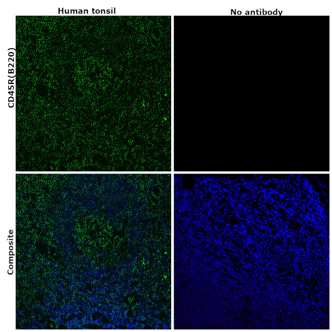 CD45R (B220) Antibody in Immunohistochemistry (Paraffin) (IHC (P))