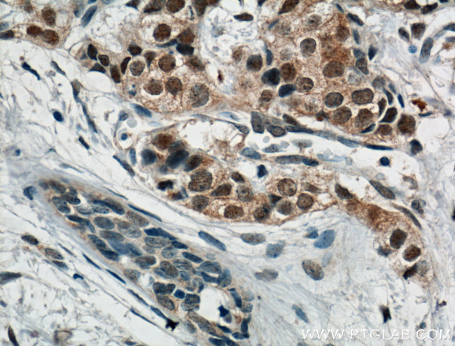 AKT Antibody in Immunohistochemistry (Paraffin) (IHC (P))