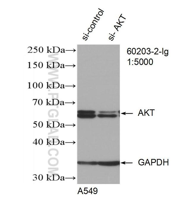 AKT Antibody in Western Blot (WB)